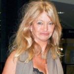 Goldie Hawn plastic surgery disaster 150x150