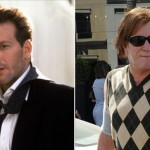 Mickey Rourke after lip surgery 150x150