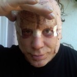 Mickey Rourke after plastic surgery photo 150x150