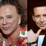 Mickey Rourke plastic surgery before and after 150x150