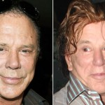 Mickey Rourke plastic surgery gone wrong 150x150