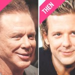 Mickey Rourke plastic surgery now and then 150x150