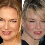 Renee Zellweger plastic surgery before and after photos 150x150