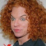 Carrot Top after facelift plastic surgery 150x150