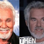 Kenny Rogers before and after facelift 150x150