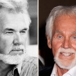 Kenny Rogers before and after pictures 150x150