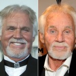 Kenny Rogers before and after plastic surgery 150x150