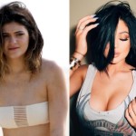 Did Kylie Jenner had breast implants plastic surgery 150x150