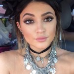 Kylie Jenner after lip implants 150x150
