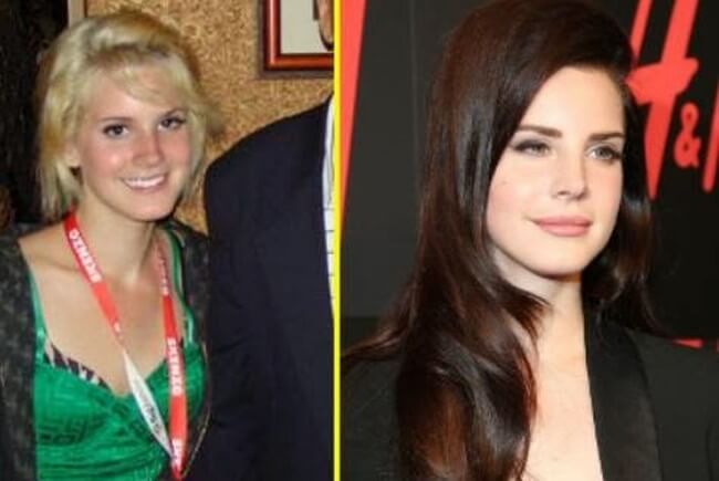 Lana Del Rey before and after