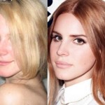 Lana Del Rey plastic surgery before and after pictures 150x150