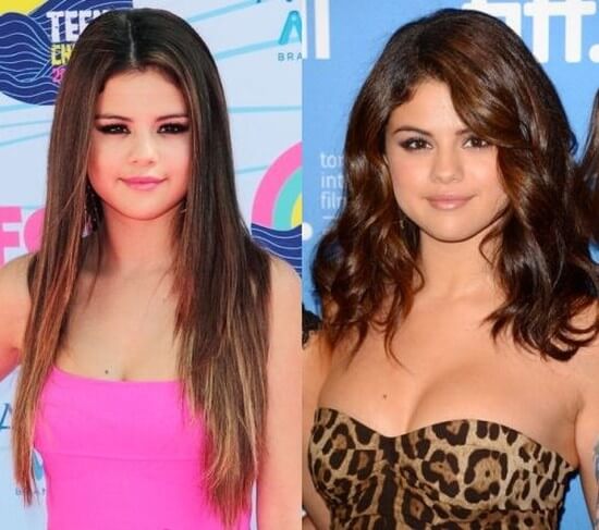 Selena Gomez before and after breast implants