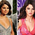Selena Gomez breast implants before and after pictures 150x150