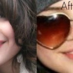 Selena Gomez nose job surgery before and after 150x150