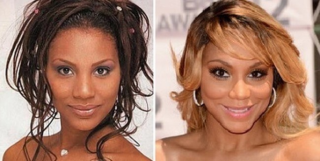 tamar braxton before and after plastic surgery