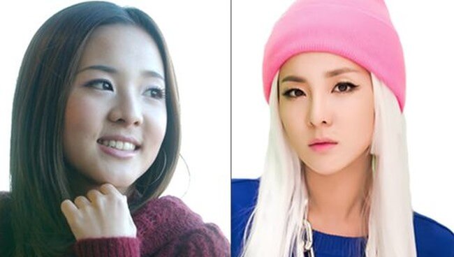 Sandara Park nose plastic surgery before and after