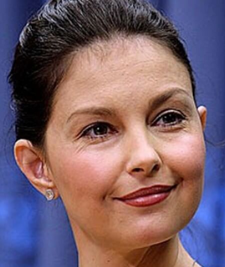 Ashley Judd Before Botox Injections