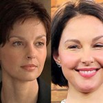 Ashley Judd Before and After Plastic Surgery 150x150
