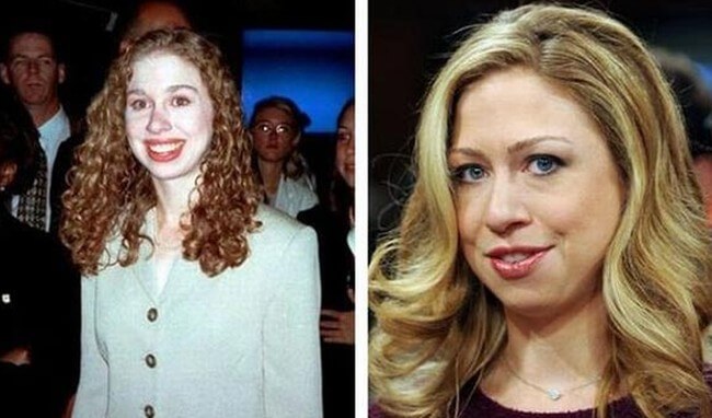 Chelsea Clinton Before And After Photos