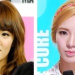 Hyoyeon Before And After Plastic Surgery 150x150