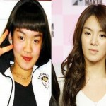 Jessica Before And After Plastic Surgery Jaw Shave 150x150