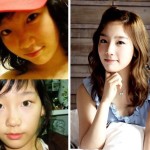 Taeyeon Before And After Plastic Surgery 150x150