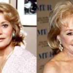 Barbara Walters Before And After Plastic Surgery 150x150