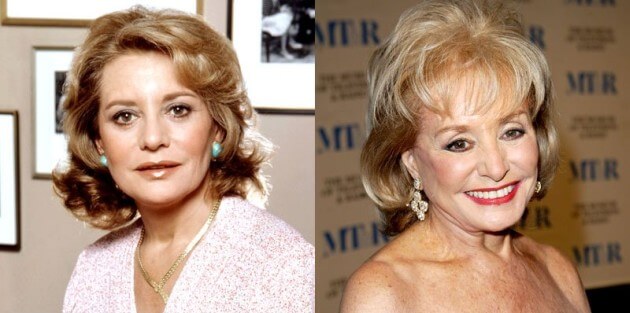 Barbara Walters Before And After Plastic Surgery