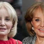 Barbara Walters Neck And Forehead Lift 150x150