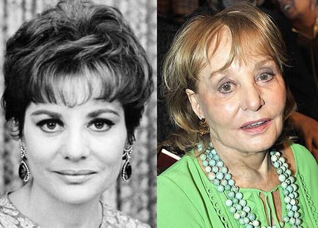 Barbara Walters Plastic Surgery Before And After Photos