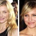 Cameron Diaz Plastic Surgery Before And After Pictures 150x150