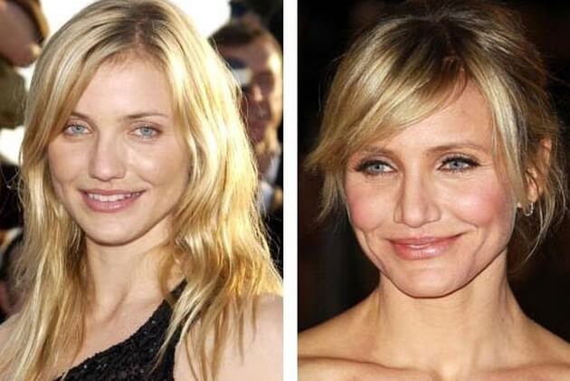 Cameron Diaz Plastic Surgery Before And After Pictures
