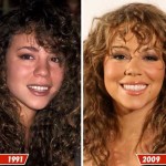 Mariah Carey Before And After Cheek Augmentation 150x150