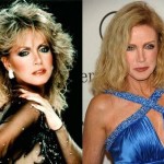 After Plastic Surgery Donna Mills Removed The Signs Of Aging 150x150