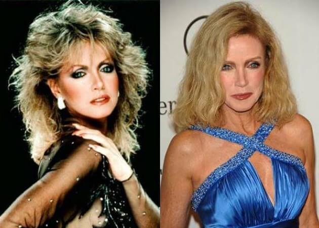 After Plastic Surgery Donna Mills Removed The Signs Of Aging