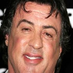 After Plastic Surgery Injectables Made Sylvester Stallones Face Look All Little Puffy 150x150