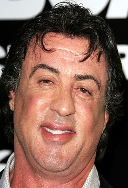 After Plastic Surgery Injectables Made Sylvester Stallones Face Look All Little Puffy