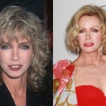 Donna Mills Before And After Plastic Surgery 150x150