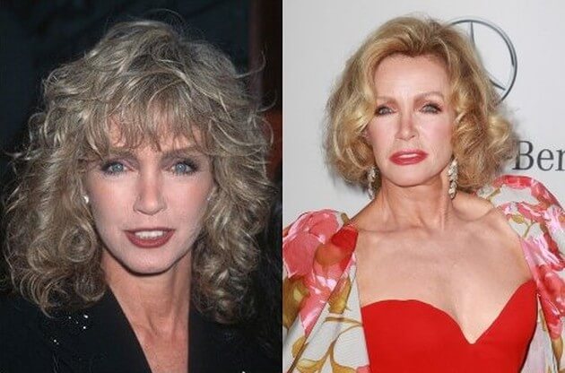 Donna Mills Before And After Plastic Surgery