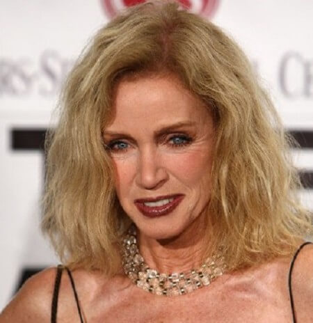 Donna Mills Eyelid Surgery Improved The Looks On Her Eyes