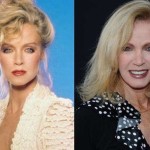 Donna Mills Plastic Surgery Before And After Photos 150x150