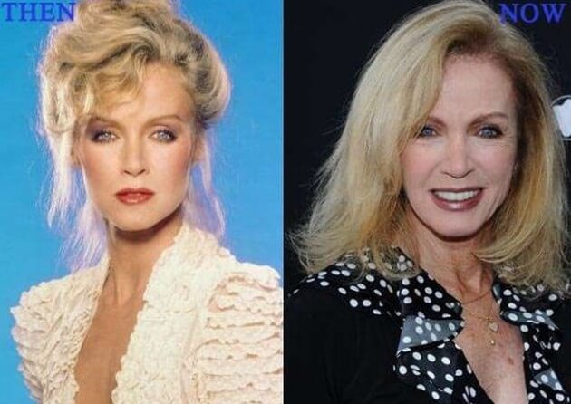 Donna Mills Plastic Surgery Before And After Photos