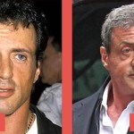 Sylvester Stallone Plastic Surgery Tighter Jaw Line 150x150