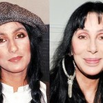 Cher Before and After Photos 150x150