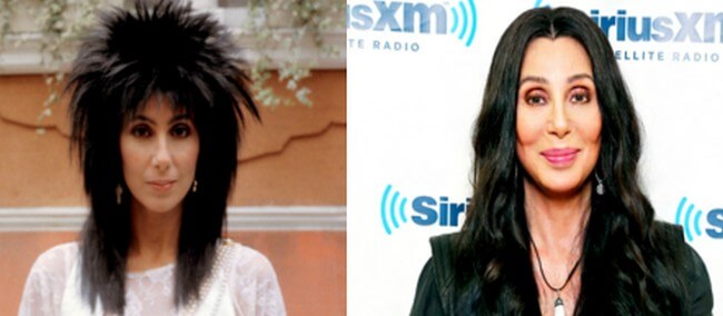 Cher Before and After Plastic Surgery