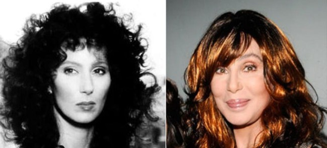 Cher Plastic Surgery Before and After