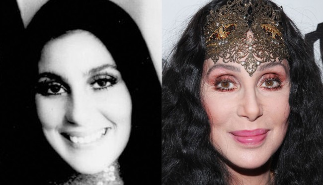 Cher looking great after plastic surgery