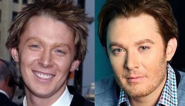 Clay Aiken before and after photos