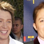 Clay Aiken before and after plastic surgery 2 150x150