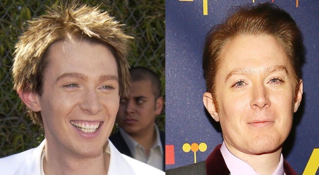 Clay Aiken before and after plastic surgery 2